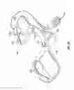 Fig. 23 - Ophthalmic surgical systems, methods, and devices