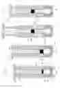Fig. 14 - Device for the fractionation of a fluid containing particles and for the extraction of a volume of interest