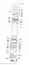 Fig. 03 - Bottle feeding device
