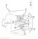Fig. 10 - Outer garment for carrying a concealed object