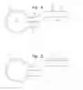 Fig. 07 - Apparatus for securing a mobile device to a steering wheel