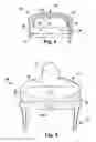 Fig. 03 - Method of making a bayonet sealing closure for containers and lids
