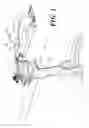 Fig. 02 - BICYCLE BRAKE SYSTEM