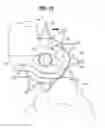 Fig. 10 - Motorcycle guard