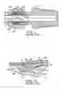 Fig. 02 - Advanced geomerty ferrule
