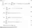 Fig. 03 - Use of spatially structured light for dynamic three dimensional reconstruction and reality augmentation
