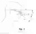 Fig. 02 - Through-the-lens (TTL) loupes with improved declination angle