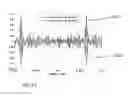 Fig. 06 - Reading method for linear tape open