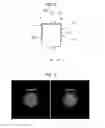 Fig. 07 - Method and system for spectral computed tomography (CT) with inner ring geometry