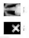 Fig. 03 - METHOD AND APPARATUS FOR ELIMINATING RESIDUAL CHARGES IN A FLAT-PANEL X-RAY DETECTOR