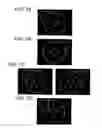 Fig. 09 - Medical image system and program