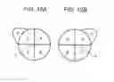 Fig. 14 - Medical image system and program