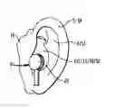 Fig. 01 - Double seal moldable earpiece system