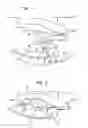 Fig. 03 - Double seal moldable earpiece system
