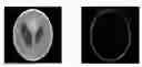 Fig. 01 - Image reconstruction from limited or incomplete data