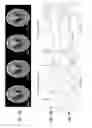 Fig. 15 - Image reconstruction from limited or incomplete data