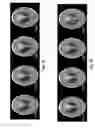 Fig. 16 - Image reconstruction from limited or incomplete data
