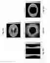 Fig. 17 - Image reconstruction from limited or incomplete data
