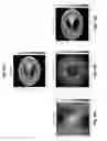 Fig. 18 - Image reconstruction from limited or incomplete data