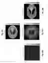 Fig. 20 - Image reconstruction from limited or incomplete data