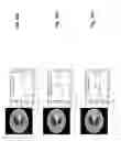 Fig. 22 - Image reconstruction from limited or incomplete data