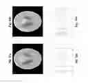 Fig. 31 - Image reconstruction from limited or incomplete data