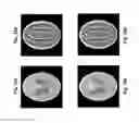 Fig. 32 - Image reconstruction from limited or incomplete data