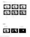 Fig. 04 - Method and system to process magnetic resonance diffusion image data