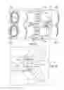 Fig. 04 - Gear pump bearing dam