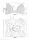 Fig. 05 - Gear pump bearing dam