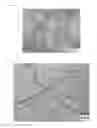 Fig. 02 - BETA-TYPE TITANIUM ALLOY HAVING LOW ELASTIC MODULUS AND HIGH STRENGTH