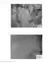 Fig. 05 - BETA-TYPE TITANIUM ALLOY HAVING LOW ELASTIC MODULUS AND HIGH STRENGTH