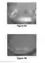 Fig. 05 - FLUID CAPTURE OF NANOPARTICLES