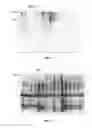Fig. 09 - CARIES RISK TEST FOR PREDICTING AND ASSESSING THE RISK OF DISEASE