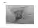 Fig. 05 - Methods for limiting development of a skin wound