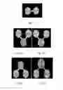 Fig. 02 - Uses of interleukin-22(IL-22) in treating and preventing nerve damage diseases or neurodegenerative diseases