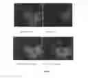 Fig. 05 - Uses of interleukin-22(IL-22) in treating and preventing nerve damage diseases or neurodegenerative diseases