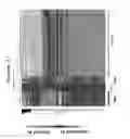Fig. 18 - INTERFERON ALPHA-INDUCED PHARMACODYNAMIC MARKERS AND USES THEREOF