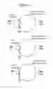 Fig. 47 - INTERFERON ALPHA-INDUCED PHARMACODYNAMIC MARKERS AND USES THEREOF