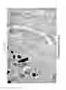 Fig. 26 - Biocompatible substrate for facilitating interconnections between stem cells and target tissues and methods for implanting same