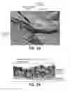 Fig. 19 - Hemostatic device and method