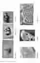 Fig. 02 - Biomatrix hydrogels and methods of use thereof