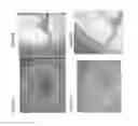 Fig. 04 - Biomatrix hydrogels and methods of use thereof