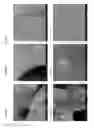 Fig. 06 - Biomatrix hydrogels and methods of use thereof