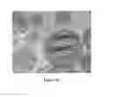 Fig. 26 - Controlled release of biological entities