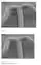 Fig. 02 - Implantable device having a slow dissolving polymer
