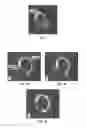 Fig. 02 - Intraocular Formulation