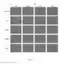 Fig. 02 - METHOD AND PHARMACEUTICAL COMPOSITION FOR LIVER FIBROSIS PREVENTION AND/OR TREATMENT