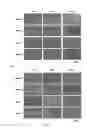 Fig. 05 - METHOD AND PHARMACEUTICAL COMPOSITION FOR LIVER FIBROSIS PREVENTION AND/OR TREATMENT