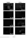 Fig. 06 - METHOD AND PHARMACEUTICAL COMPOSITION FOR LIVER FIBROSIS PREVENTION AND/OR TREATMENT